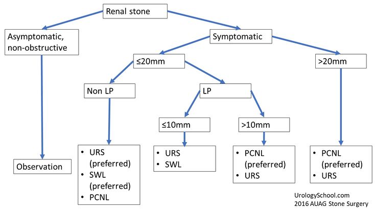 Stones: Treatment Selection for Upper Urinary Tract Calculi ...